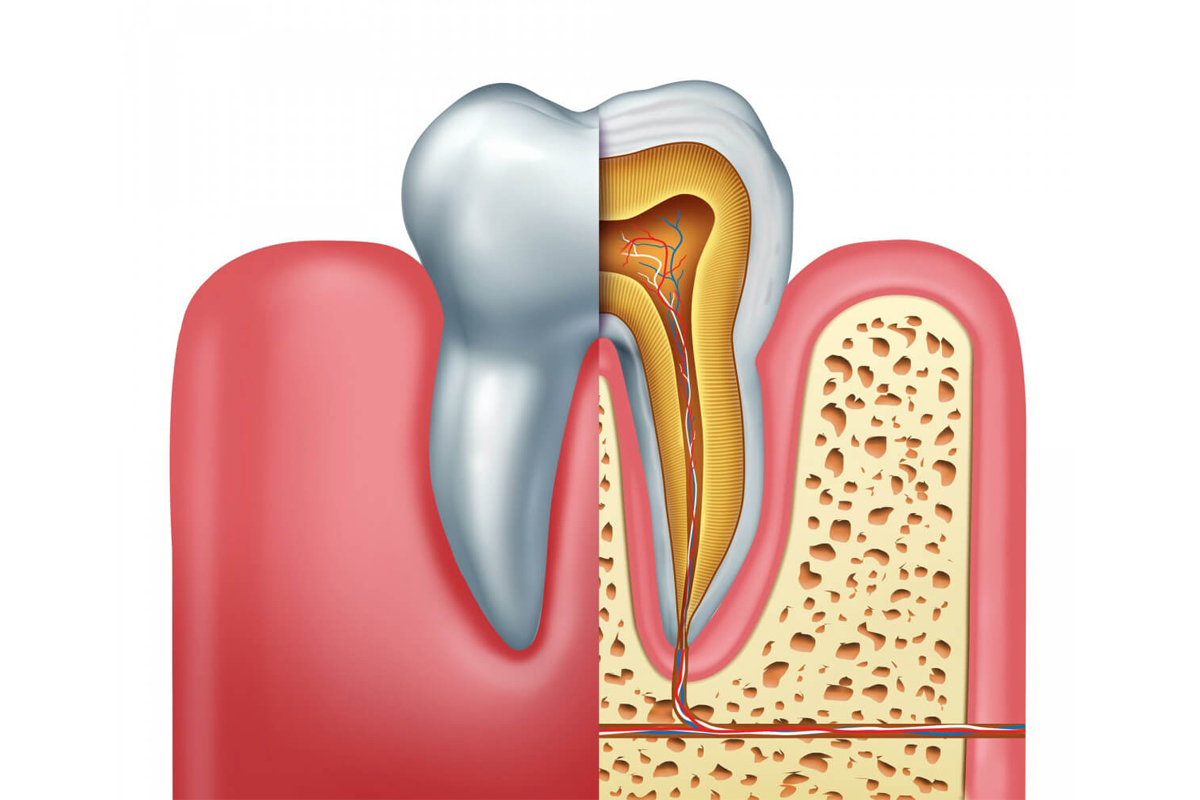 Save Your Smile From Decay With Root Canal Therapy