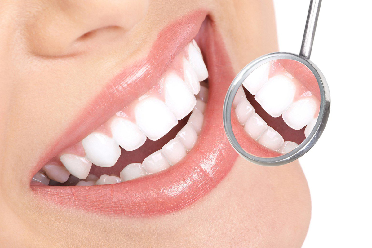 Unlock Your Best Smile With Dental Bonding