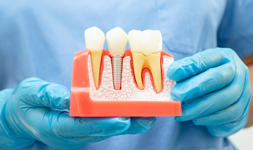 root canal renaissance restoring teeth