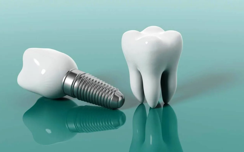 Guide to dental implant healing