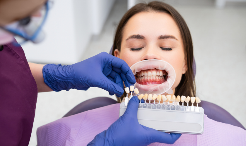 Dental veneers for patients with teeth grinding issues